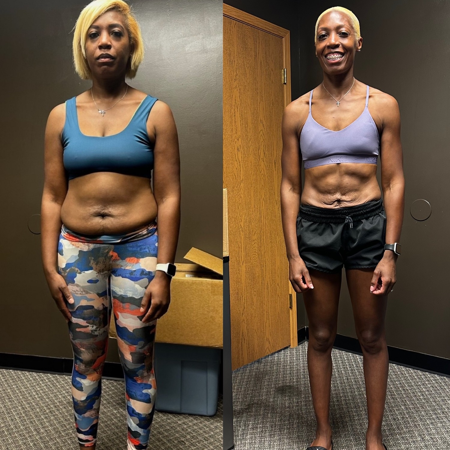 Before and after, front view: a Coach JR client with a flatter, more defined midsection after coaching.